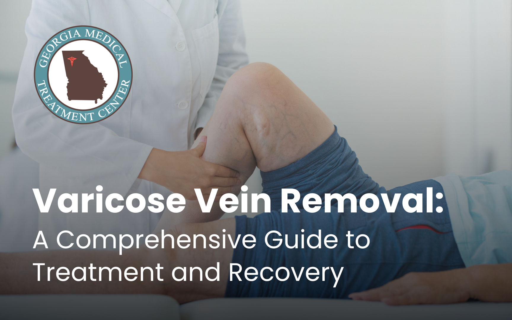 Varicose Vein Removal: A Comprehensive Guide to Treatment and Recovery