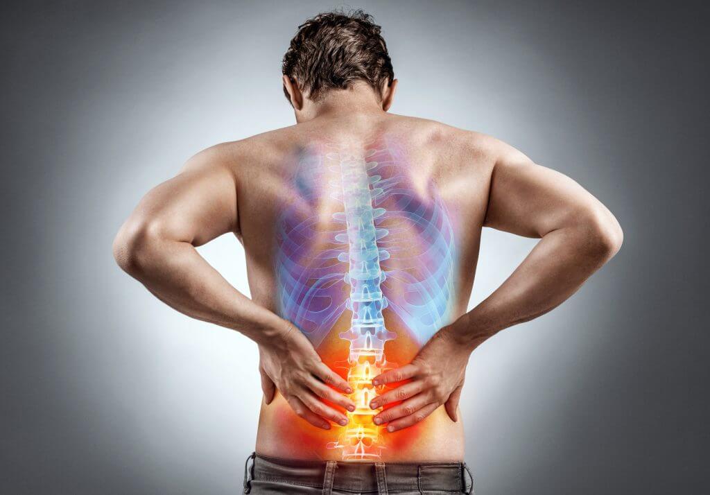 back pain conditions