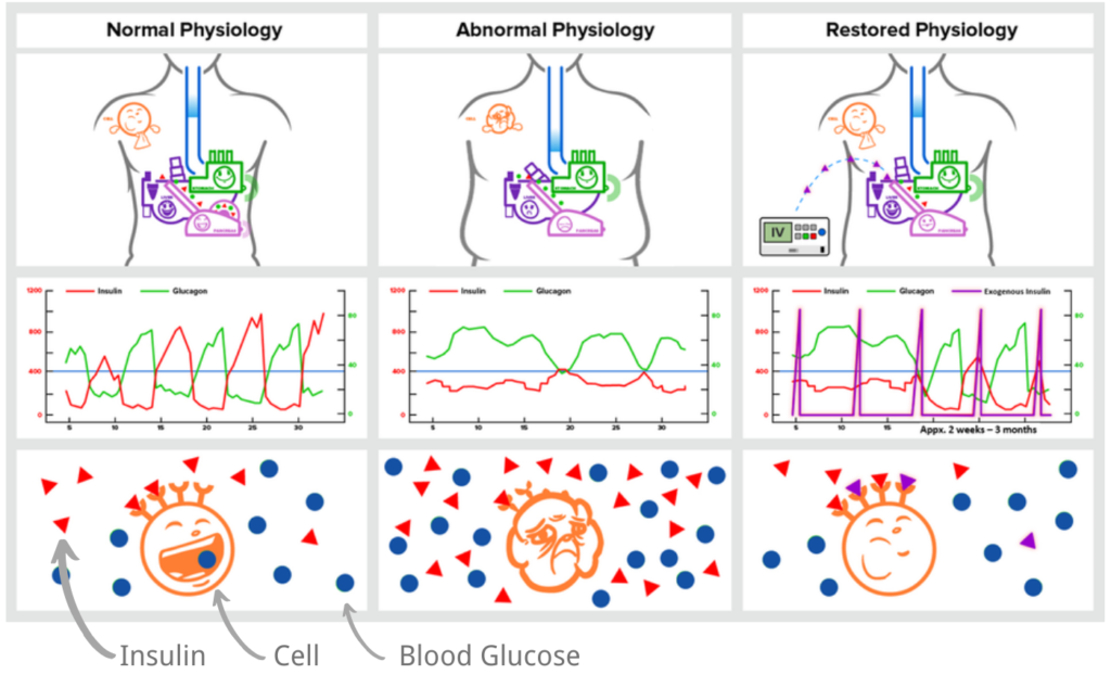 Diabetes 3 Phase Treatment