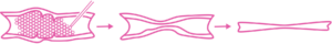 Varithena treatment diagram