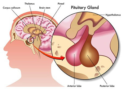 Hormone Replacement Therapy