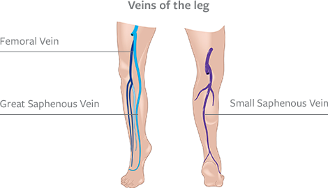 Leg Vein Location Chart