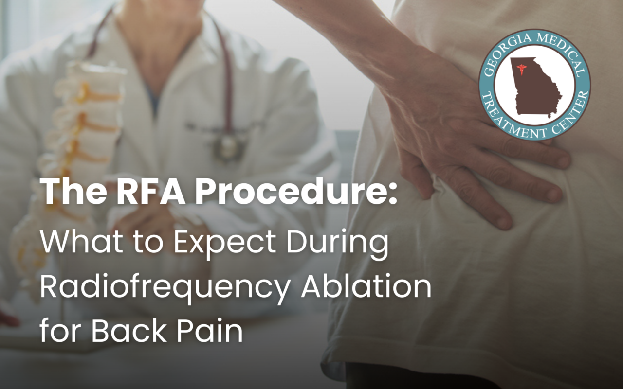 Radiofrequency Ablation for Back Pain: What to Expect